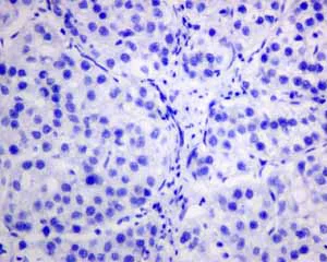 Immunohistochemistry (Formalin/PFA-fixed paraffin-embedded sections) - Anti-Rhodopsin antibody [EPR7996] - BSA and Azide free (AB249189)