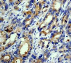 Immunohistochemistry (Formalin/PFA-fixed paraffin-embedded sections) - Anti-RhoGAP antibody [EP489Y] (AB32328)