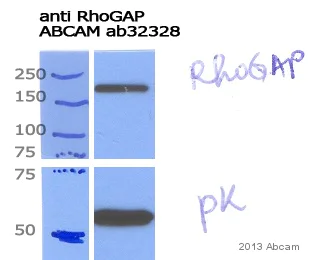 Western blot - Anti-RhoGAP antibody [EP489Y] (AB32328)