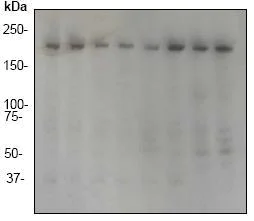 Western blot - Anti-RhoGAP antibody [EP489Y] (AB32328)