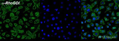 Immunocytochemistry/ Immunofluorescence - Anti-RhoGDI antibody [2G3] (AB135252)