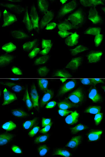 Immunocytochemistry/ Immunofluorescence - Anti-RhoGDI antibody (AB175243)