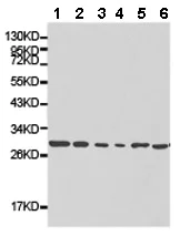 Western blot - Anti-RhoGDI antibody (AB175243)