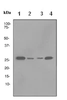 Western blot - Anti-RhoGDI antibody [EPR3772] (AB108977)