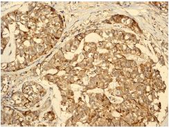 Immunohistochemistry (Formalin/PFA-fixed paraffin-embedded sections) - Anti-RhoGDI antibody [EPR3773] (AB133248)