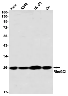Western blot - Anti-RhoGDI Antibody [S07-1D8] (AB317431)