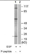 Western blot - Anti-RhoGDI (phospho S174) antibody (AB74142)