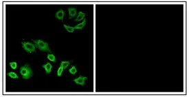 Immunocytochemistry/ Immunofluorescence - Anti-RHOH antibody (AB118507)