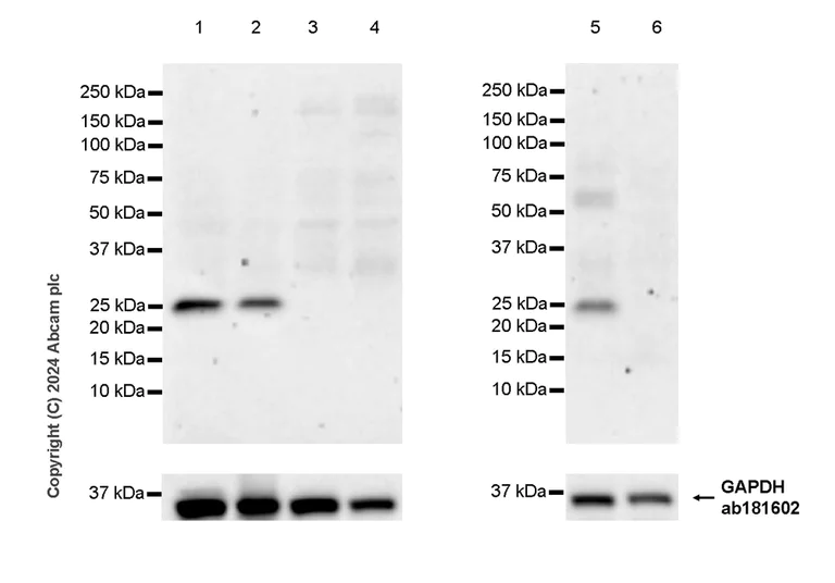 Western blot - Anti-RHOJ antibody [EPR28959-55] - BSA and Azide free (AB317700)