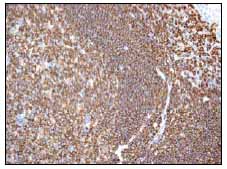 Immunohistochemistry (Formalin/PFA-fixed paraffin-embedded sections) - Anti-RIAM antibody [EPR2806] (AB92537), expandable thumbnail