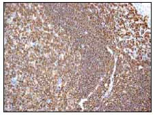 Immunohistochemistry (Formalin/PFA-fixed paraffin-embedded sections) - Anti-RIAM antibody [EPR2806] (AB92537)