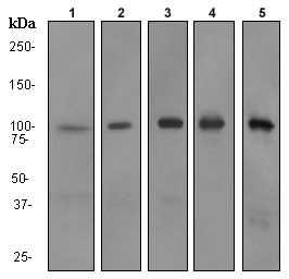 Western blot - Anti-RIAM antibody [EPR2806] (AB92537), expandable thumbnail