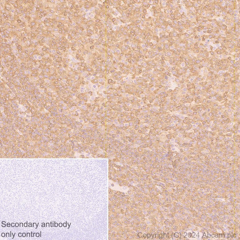 Immunohistochemistry (Formalin/PFA-fixed paraffin-embedded sections) - Anti-RIAM antibody [EPR2806] - BSA and Azide free (AB247579)