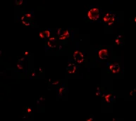 Immunocytochemistry - Anti-Ribonuclease H2, subunit A/RNASEH2A antibody (AB83943)