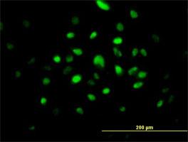 Immunocytochemistry/ Immunofluorescence - Anti-Ribonuclease H2, subunit A/RNASEH2A antibody (AB92876)