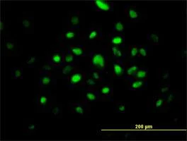 Immunocytochemistry/ Immunofluorescence - Anti-Ribonuclease H2, subunit A/RNASEH2A antibody (AB92876)