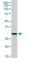 Western blot - Anti-Ribonuclease H2, subunit A/RNASEH2A antibody (AB92876)