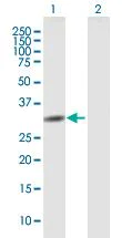 Western blot - Anti-Ribonuclease H2, subunit A/RNASEH2A antibody (AB92876)