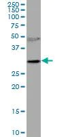 Western blot - Anti-Ribonuclease H2, subunit A/RNASEH2A antibody (AB92876)