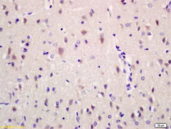 Immunohistochemistry (Formalin/PFA-fixed paraffin-embedded sections) - Anti-Ribonuclease Inhibitor/RAI antibody (AB203658)