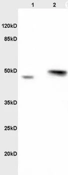 Western blot - Anti-Ribonuclease Inhibitor/RAI antibody (AB203658)