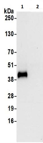 Immunoprecipitation - Anti-Ribonuclease Inhibitor/RAI antibody (AB217132)