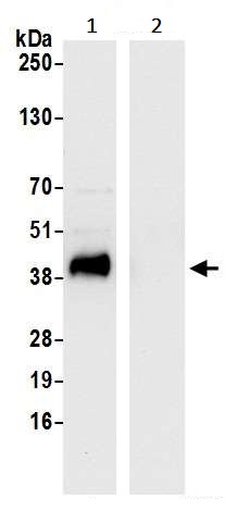 Immunoprecipitation - Anti-Ribonuclease Inhibitor/RAI antibody (AB245627)