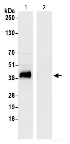 Immunoprecipitation - Anti-Ribonuclease Inhibitor/RAI antibody (AB245627)