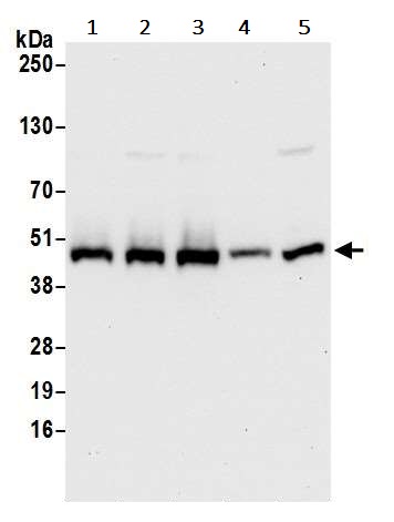 Western blot - Anti-Ribonuclease Inhibitor/RAI antibody (AB245627)