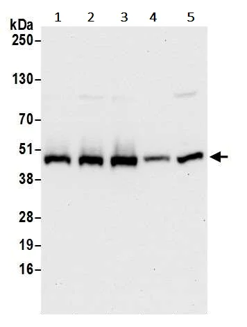 Western blot - Anti-Ribonuclease Inhibitor/RAI antibody (AB245627)