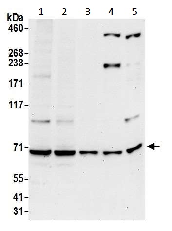 Western blot - Anti-Ribophorin I antibody (AB240597)