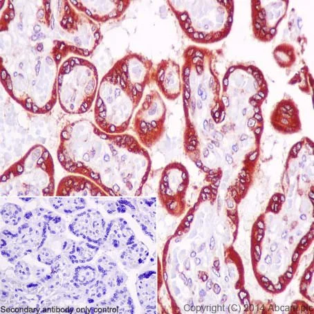 Immunohistochemistry (Formalin/PFA-fixed paraffin-embedded sections) - Anti-Ribophorin I antibody [EPR17043(B)] - BSA and Azide free (AB232599)