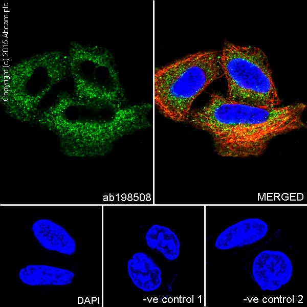 Immunocytochemistry/ Immunofluorescence - Anti-Ribophorin I antibody [EPR17043(B)] - N-terminal (ab198508), expandable thumbnail