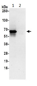 Immunoprecipitation - Anti-RIC8A antibody (AB194941)
