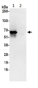 Immunoprecipitation - Anti-RIC8A antibody (AB194941)