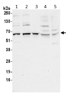 Western blot - Anti-RIC8A antibody (AB194941)