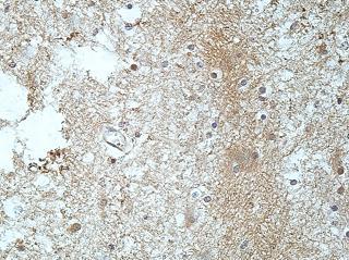 Immunohistochemistry (Formalin/PFA-fixed paraffin-embedded sections) - Anti-RIC8B antibody (AB170006), expandable thumbnail