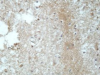 Immunohistochemistry (Formalin/PFA-fixed paraffin-embedded sections) - Anti-RIC8B antibody (AB170006)