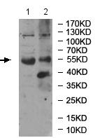 Western blot - Anti-RIC8B antibody (AB170006), expandable thumbnail