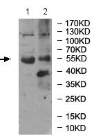 Western blot - Anti-RIC8B antibody (AB170006)