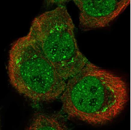 Immunocytochemistry/ Immunofluorescence - Anti-RICS antibody (AB150847)