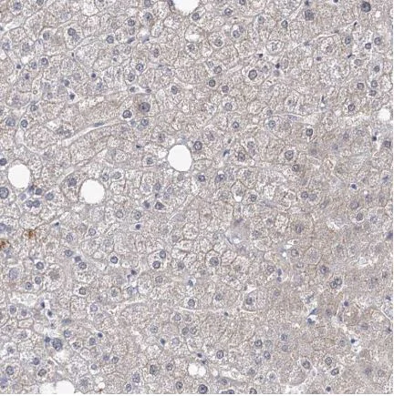 Immunohistochemistry (Formalin/PFA-fixed paraffin-embedded sections) - Anti-RICS antibody (AB150847)