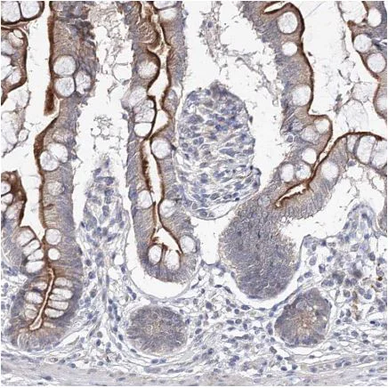 Immunohistochemistry (Formalin/PFA-fixed paraffin-embedded sections) - Anti-RICS antibody (AB150847)