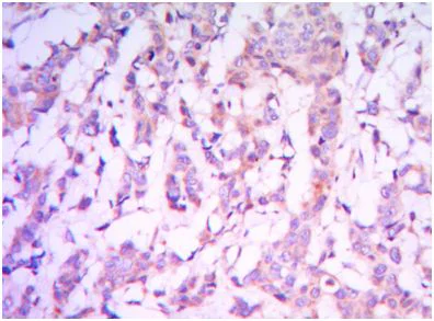 Immunohistochemistry (Formalin/PFA-fixed paraffin-embedded sections) - Anti-RICTOR antibody [7B3] (AB104838)