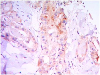 Immunohistochemistry (Formalin/PFA-fixed paraffin-embedded sections) - Anti-RICTOR antibody [7B3] (AB104838)