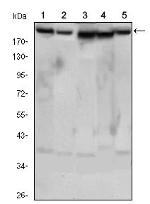 Western blot - Anti-RICTOR antibody [7B3] (AB104838)