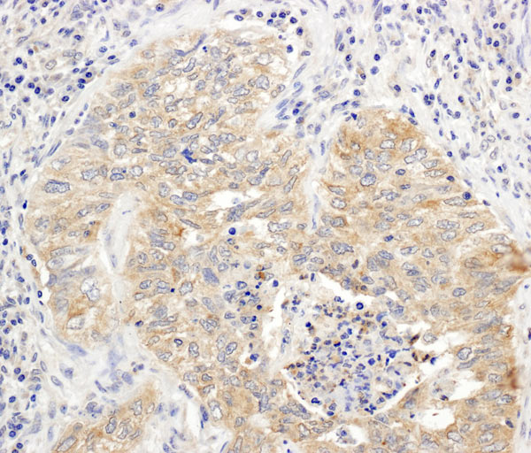 Immunohistochemistry (Formalin/PFA-fixed paraffin-embedded sections) - Anti-RICTOR antibody (AB70374)