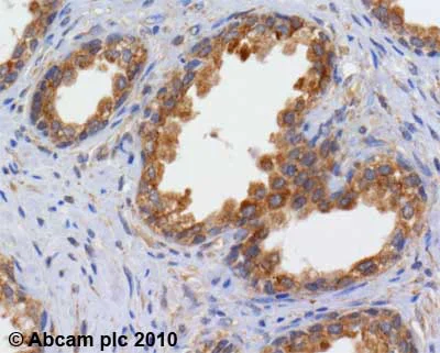 Immunohistochemistry (Formalin/PFA-fixed paraffin-embedded sections) - Anti-RICTOR antibody (AB70374)
