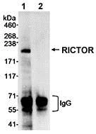 Immunoprecipitation - Anti-RICTOR antibody (AB70374)
