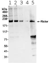 Western blot - Anti-RICTOR antibody (AB70374)